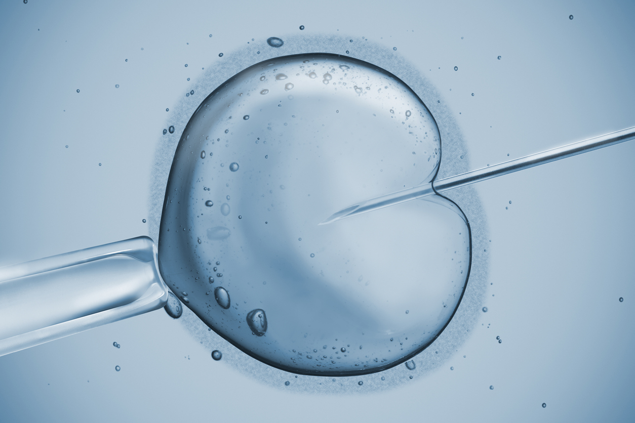 Ivf And Icsi Sperm Injection Trinidad And Tobago Ivf And Fertility Centre 